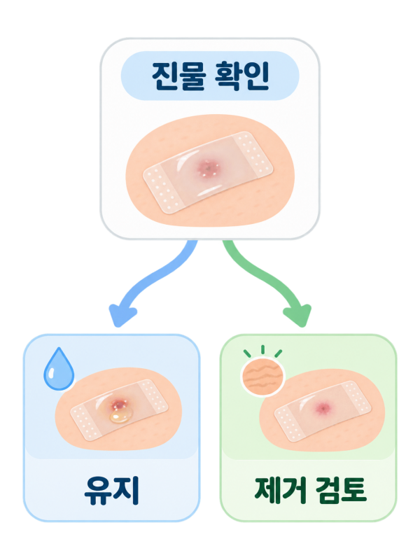 진물 멎으면 / 제거 검토 - 진주점제거 4 | 미미썸의원 진주점