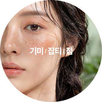 기미, 잡티, 점